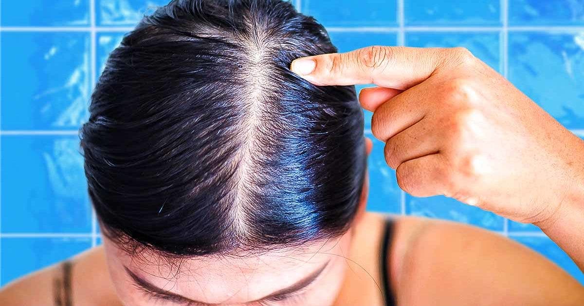 how-to-get-rid-of-oily-hair-without-washing-it?-the-secret-that-few-women-know
